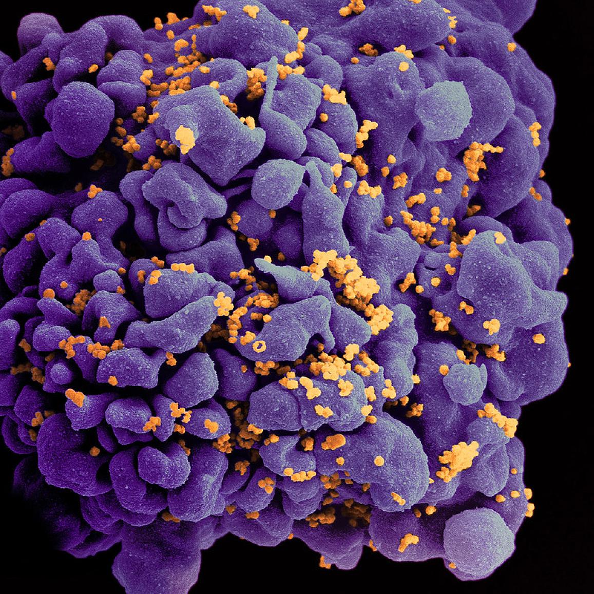 Scanning electron micrograph of an HIV-infected H9 T cell, colorized in Halloween colors. NIAID