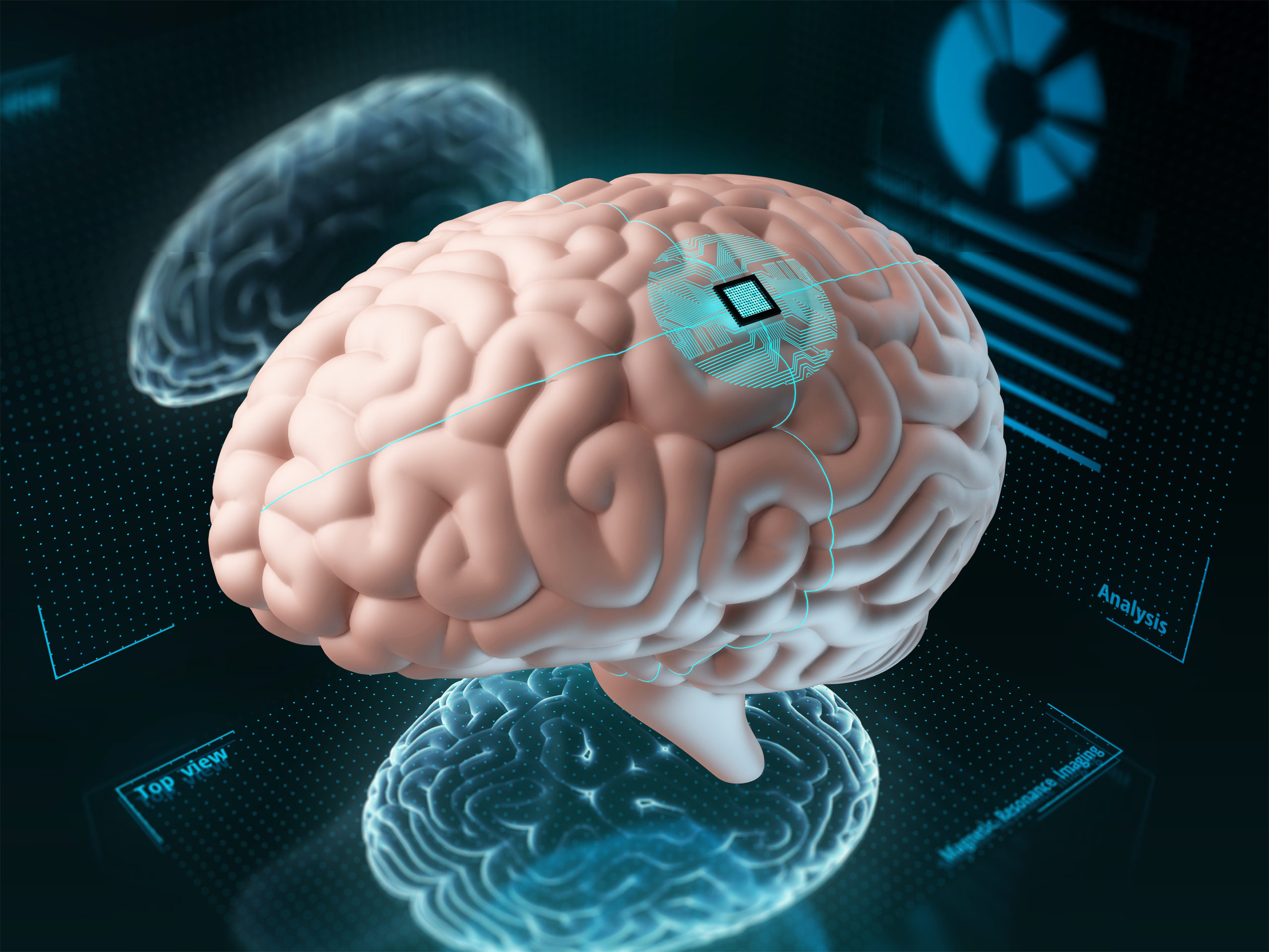 human-brain-with-an-implanted-chip